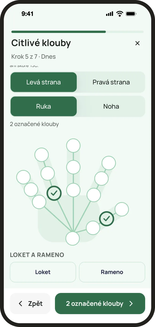 Mapa těla v aplikaci FlareEase: obrys ruky s klouby, dva jsou označeny jako citlivé